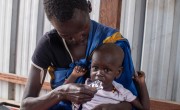 Baby Nyayuach receives therapeutic food at a Concern nutrition centre in South Sudan. (Photo: Jon Hozier-Byrne / Concern Worldwide)