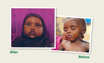 Before and after photo of Nala. Photo: Concern Worldwide.