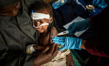 A nurse checks on 3 year old Jamel who has measles and a fever at Banaadir hospital in Mogadishu. His family had to leave their village due to drought. Photo by Mustafa Saeed for Concern Worldwide