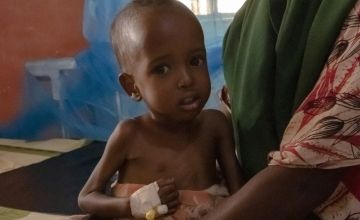 African infant girl suffering from wasting with tube in his hand