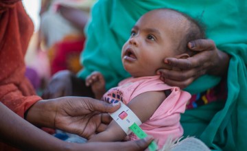 Aida (2) is screened for malnutrition during at a referral centre for children under five in River Nile State, Sudan