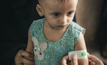 Rima* has her mid-upper-arm circumference (MUAC) measured by a community health volunteer at a Concern-supported clinic in Al-Shaqa'a village, Yemen. Photo: Ammar Khalaf/Concern Worldwide