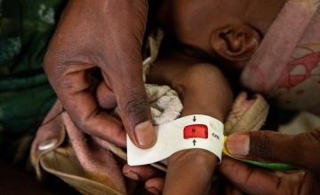 A young child getting checked for malnutrition