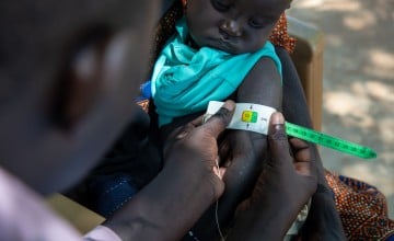 Malual is screened with a middle-upper-arm circumference (MUAC) band. When tightened on the arm, the colours indicate the child’s status: red for severe acute malnutrition, yellow for moderate acute malnutrition, and green for no acute malnutrition. Photo: Eugene Ikua/Concern Worldwide