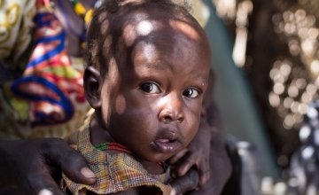 14-month-old Chan Adim Garang is one of twins admitted to the outpatient therapeutic programme run by Concern in Maduany in Aweil North, South Sudan. Photo Kieran McConville/Concern Worldwide.