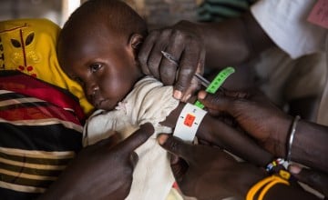 Two year old Eunice*, being screened for malnutrition by staff of Nile Hope, a South Sudanese NGO which is supported by Concern Worldwide. Photo: Kieran McConville/Concern Worldwide.*Name changed for security purposes.