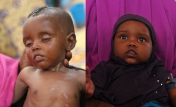 Two photos of baby Nala with just a few months in the difference. Photo: Mohamed Abdiwahab/Concern Worldwide. 