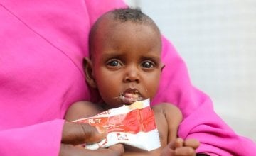 Nine month old Nala pictured here in a Concern supported health centre in Mogadishu, Somalia. Photo: Jennifer Nolan / Concern Worldwide