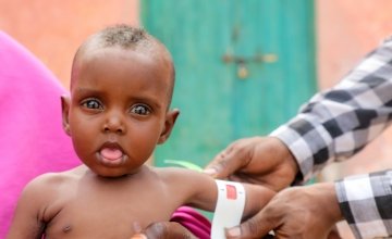 Nala was born underweight and malnourished in Somalia but is getting the help she needs from Concern Worldwide staff
