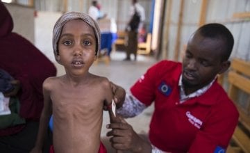 Yasmiin Hassan (5) when she weighed just 12.5kg in March, 2017 being treated by Hashim Jelle at a Concern Worldwide nutrition centre in Mogadishu, Somalia where war and drought displaced over 1.1 million and caused a major food crisis