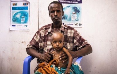 Concerned man sitting in blue plastic chair with child suffering from malnutrition sitting on his lap