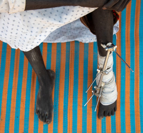 Alafia's injuries after being shot in the leg