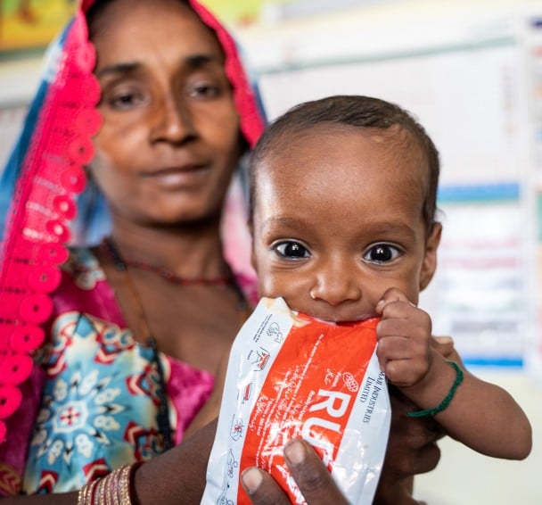 Mukesh (2) receives treatment at the Nutrition Stabilization Centre in the Taluka Hospital Chachro, Tharparkar with the support of Concern. 