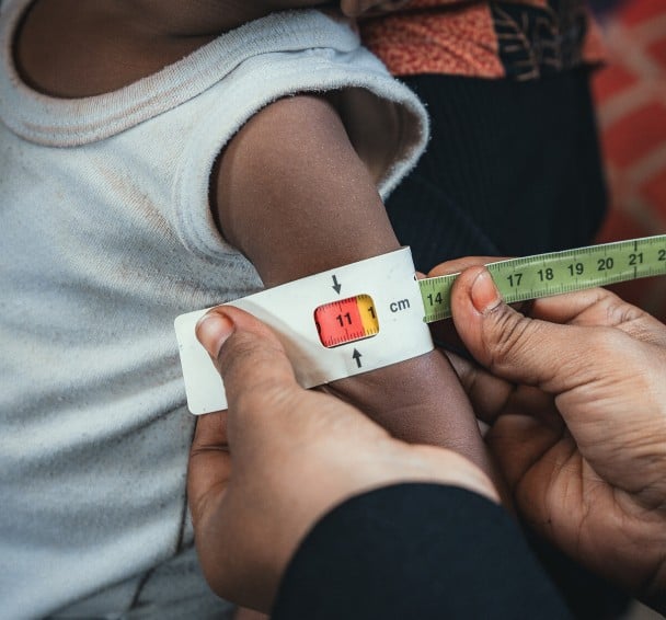 Child having middle upper arm circumference checked