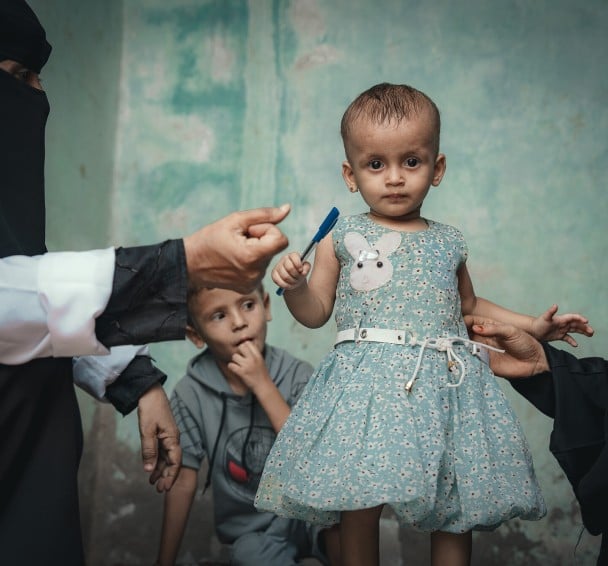 Rima receiving treatment for malnutrition 