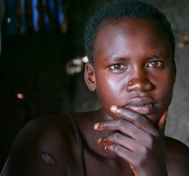 Kauuai Gorey's daughter Nyaruon Yak Mut (21) at home in Budaang Payam, Rubkona County