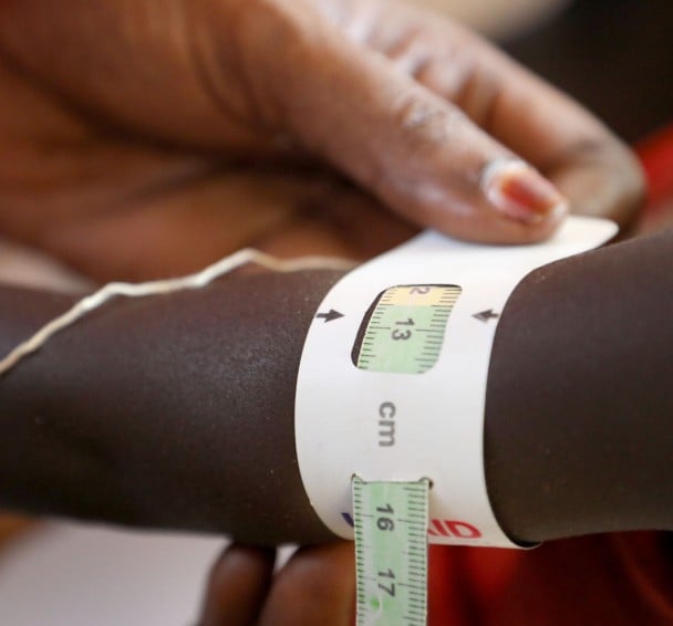 Child having middle upper arm circumference checked