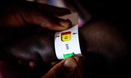 A 11 month old baby is measured for malnutrition
