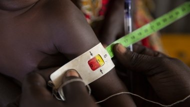 A child gets MUAC measurement assessed by a nutrition assistant at a Nutrition Centre in Gambella, Ethiopia.