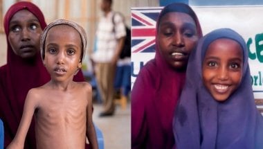 Five-year-old Yasmiin&#039;s* life has been transformed due to treatment at a Concern health centre in Mogadishu, Somalia. Photo: Concern Worldwide. 