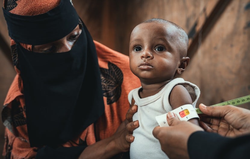 Community health worker assessing infant in Yemen 