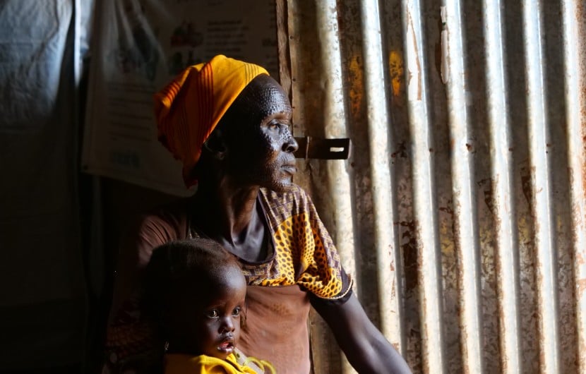 Nyacanya Chatiem with her grandchild Liakuoth (2) attending Kuach PHCC Nutrition clinic in Guit County, South Sudan. Photo: Eugene Ikua/Concern Worldwide