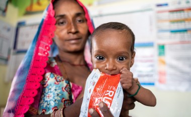 Mukesh (2) receives treatment