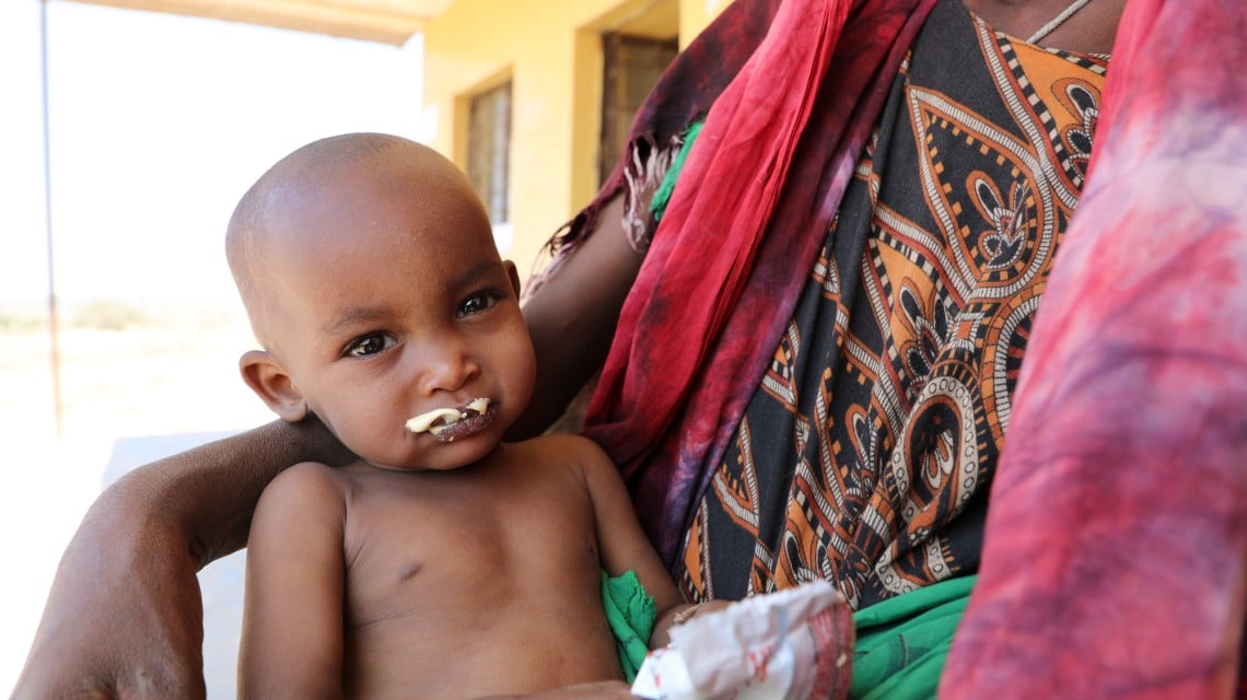 Halimo Hassan (1 year and 2 months) and mother Khayro Ali Hassan (30) in a remote health centre in Filtu, Somali Region. Halimo is being treated for severe acute malnutrition with the support of International NGO Concern Worldwide. Photo: Jennifer Nolan / Concern Worldwide.