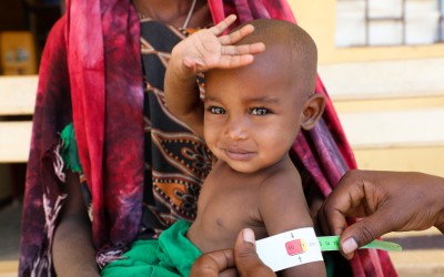 Halimo Hassan (1 year and 2 months) and mother Khayro Ali Hassan (30) in a remote health centre in Filtu, Somali Region. Halimo is being treated for severe acute malnutrition with the support of International NGO Concern Worldwide. Photo: Jennifer Nolan/ Concern Worldwide.