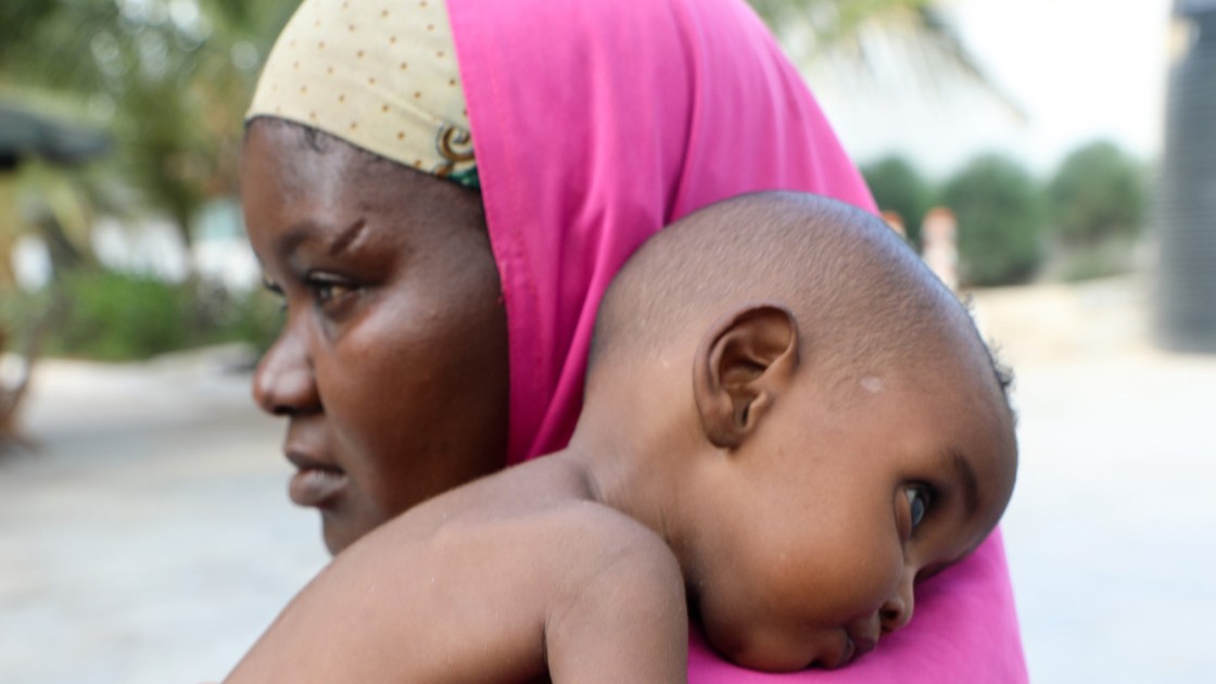 Nala pictured here with her mother Hani (23) in a Concern supported health centre in Mogadishu, Somalia. Photo: Jennifer Nolan /Concern Worldwide.