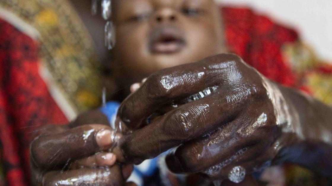 A mother in Ethiopia washes her child’s hands with soap and water at a Concern nutrition clinic. Photo: Kieran McConville