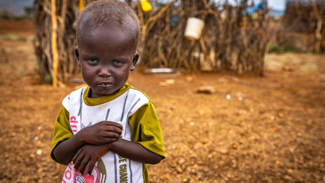 Erupe is malnourished as a result of drought in Kenya.