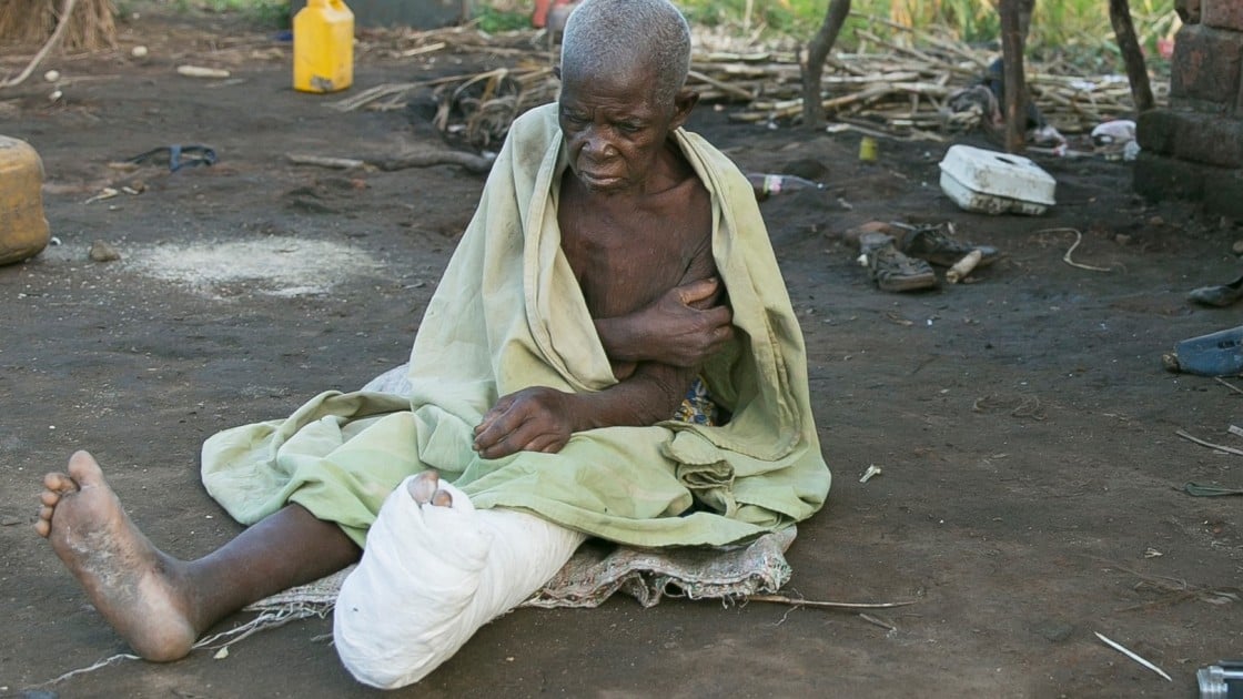 Dominga Gambulene was injured when the family home in Chicuacha village, Lamego collapsed during Cyclone Idai. Photo: Kieran McConville/Concern Worldwide.