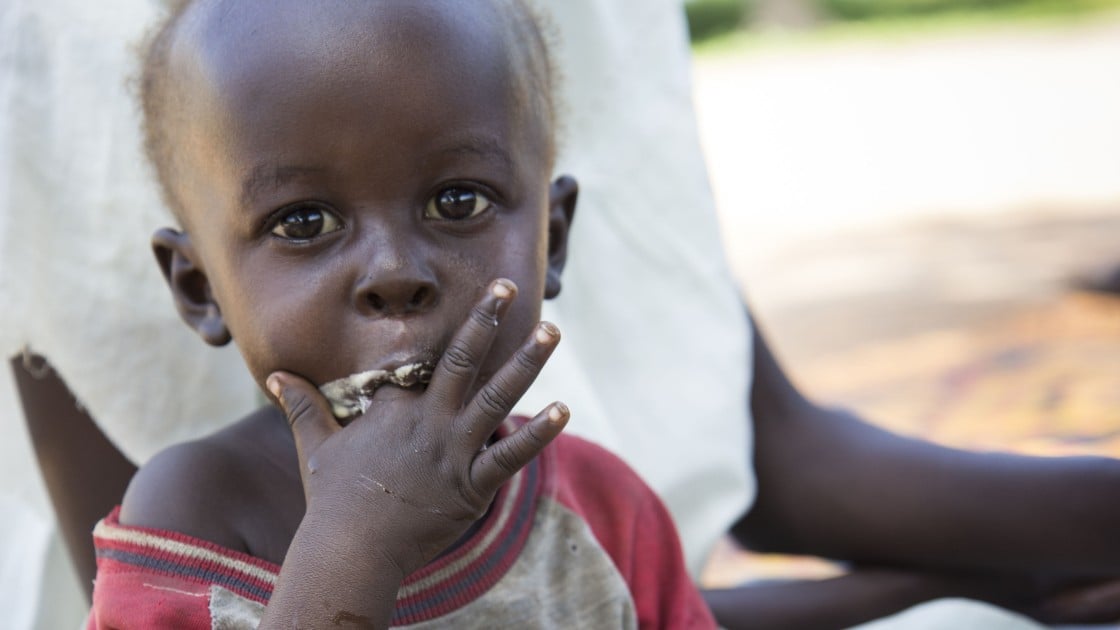 Yak eats ready-to-eat therapeutic foods at Mayom Health Care Unit in Aweil West County, Northern Bahr el Gazal, South Sudan. Photo: Crystal Wells/Concern Worldwide.