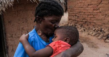 Caustasie (61) kisses her grandson Emmanuel (1) who survived a acute malnutrition thanks to a health centre supported by Concern Worldwide Kiambi village in the DRC