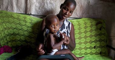 An 18-month-old Kenyan girl receives treatment for severe malnutrition