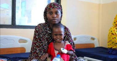 Mulki, who is just 18 months old, was being treated at Mogadishu’s Banadir Hospital for malnutrition, after being brought there by her mother Cawo.