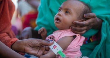 Aida (2) is screened for malnutrition during at a referral centre for children under five in River Nile State, Sudan