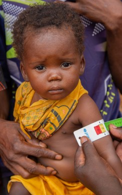 Ndakala Merveille has her MUAC measurement taken