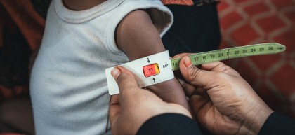 Child having middle upper arm circumference checked