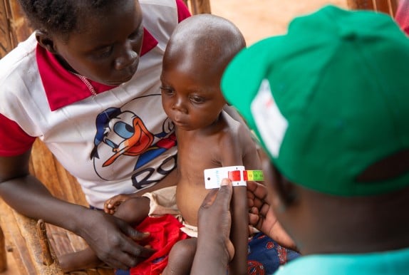 Child being checked for malnutrition in CAR