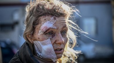 A wounded woman stands outside a hospital after the bombing of the eastern Ukraine town of Chuguiv on February 24, 2022. Photo: Aris Messinis / AFP.