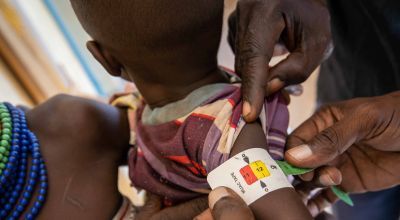 A child’s arm is measured at a malnutrition clinic in Kenya
