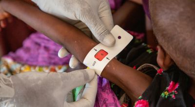Leyla (aged 4) have her Mid-upper arm circumference, (MUAC), measured at the Siika Dheer Health Centre in Somalia, supported by Concern