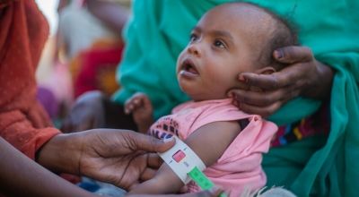Aida (2) is screened for malnutrition during at a referral centre for children under five in River Nile State, Sudan