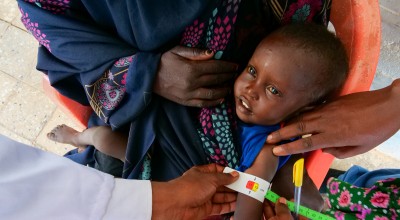 Mubashir getting his MUAC measurements taken in Ethiopia