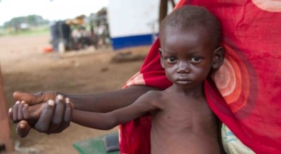 Explainer: What (and When) Is A Famine? | Concern Worldwide