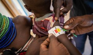 A child’s arm is measured at a malnutrition clinic in Lekwasimyen in Northern Kenya's Turkana province. Photo: Lisa Murray / Concern Worldwide.