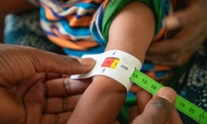 9-month-old Tenay has her MUAC taken. Photo: Eugene Ikua/Concern Worldwide.