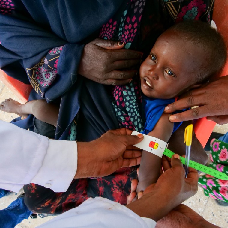 Mubashir getting his MUAC measurements taken in Ethiopia